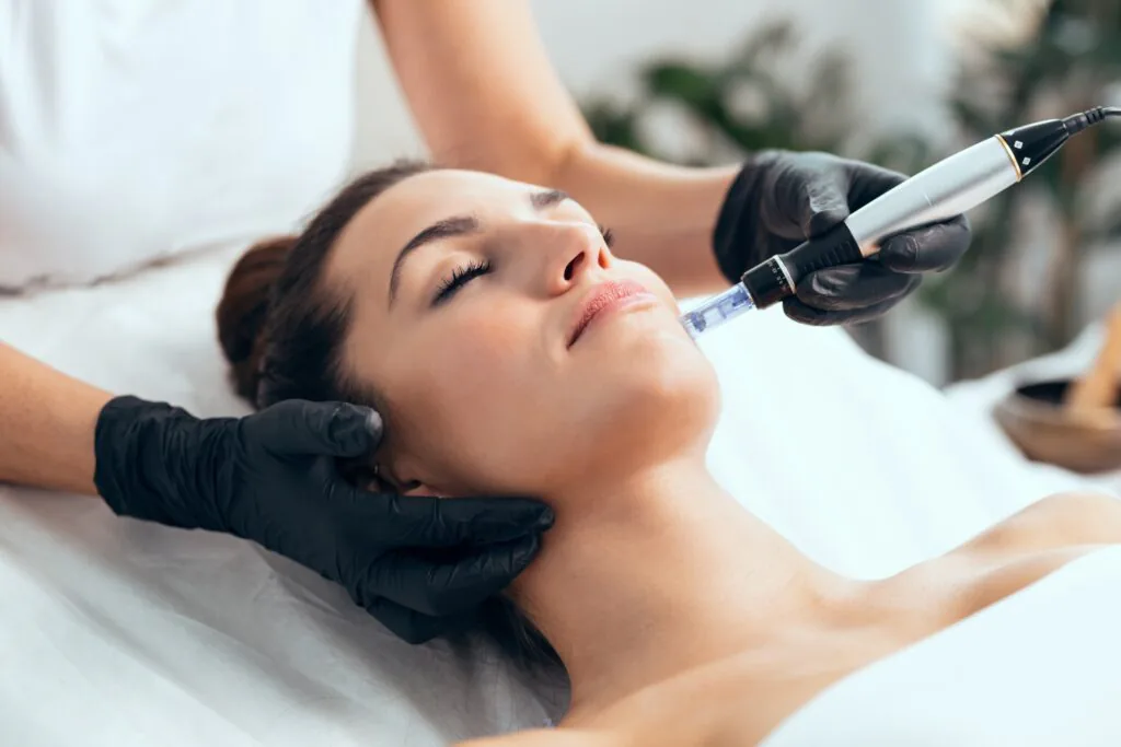 Microneedling Behandlung im Kosmetikstudio Dammbeauty Langerwehe — Kollagen-Stimulation für straffere Haut